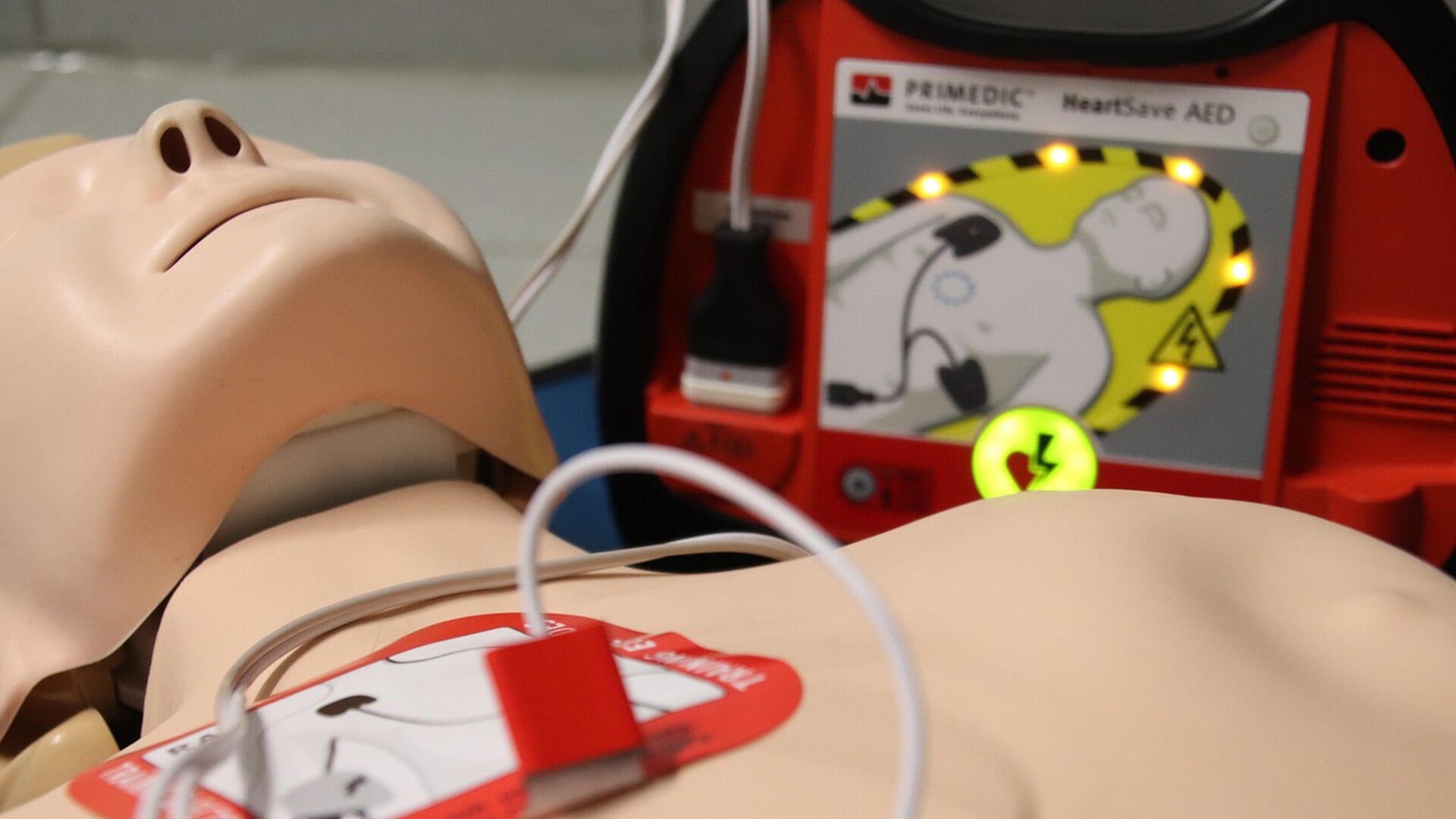 AED’s voor auto’s van Ermelose boa’s