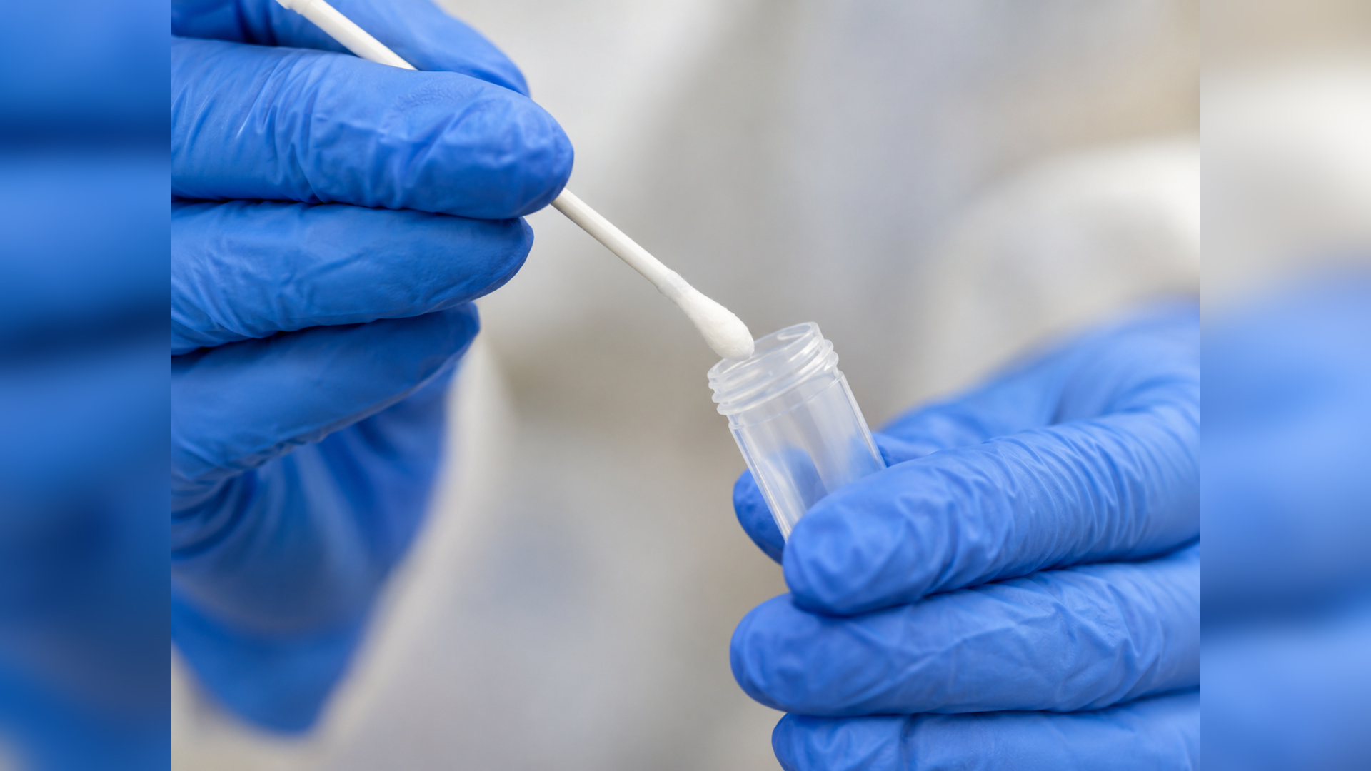 GGD IJsselland records more syphilis and HIV cases in 2025