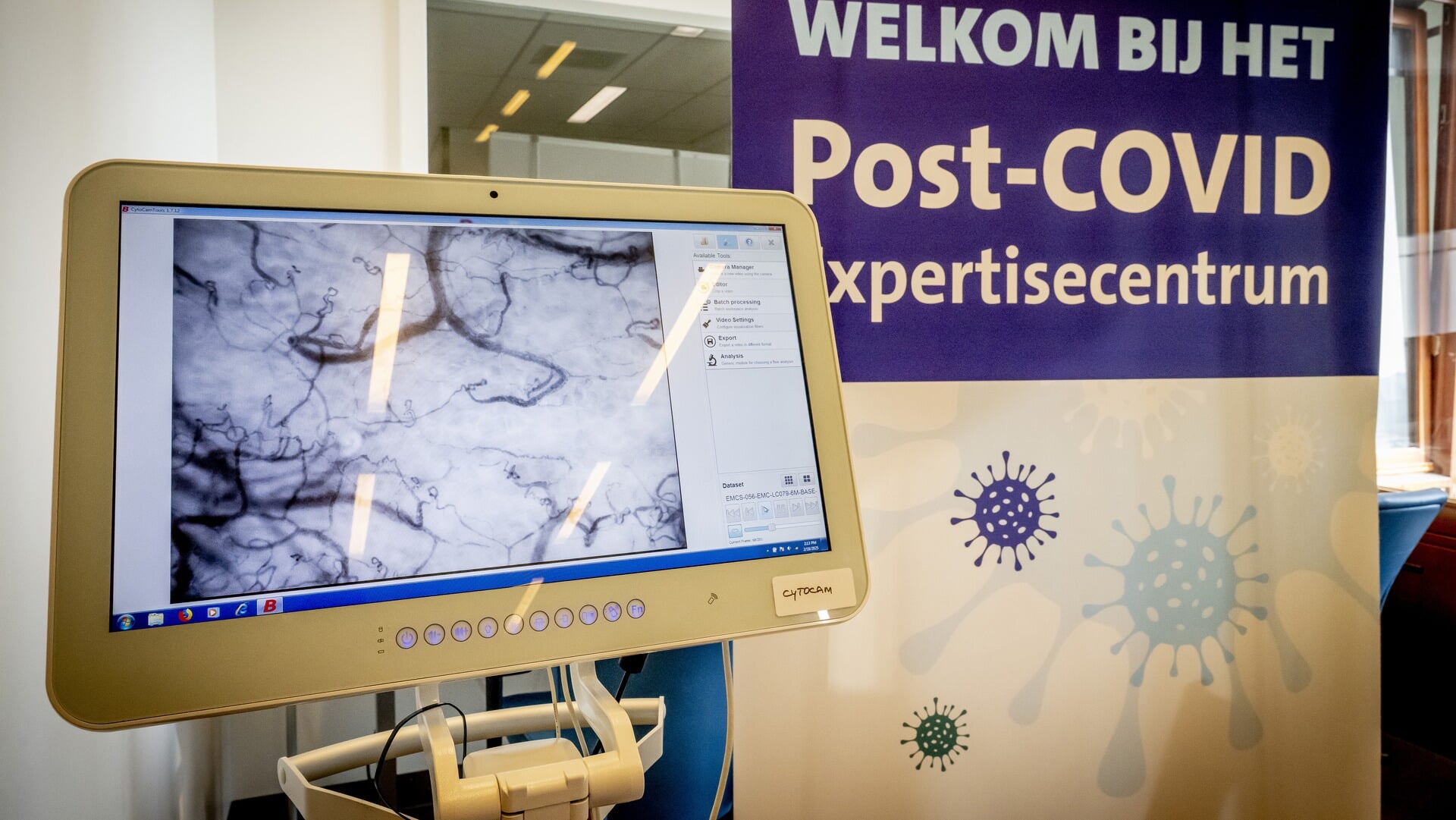 Speciale centra voor postcovid zijn een jaar open: ‘Stapsgewijs krijgen patiënten iets meer kwaliteit van leven’